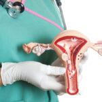 Cancer Cells : గర్భాశయ క్యాన్సర్ కణాలను చంపేసే మైక్రో ఆర్ఎన్ఏ