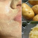 Skin Problems : చర్మ సమస్యలకు చెక్‌పెట్టే బంగాళాదుంప
