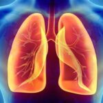 Lung Inflammation: ఊపిరితిత్తుల్లో వాపును ముందే కనిపెట్టవచ్చా?