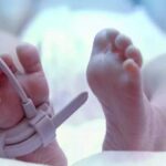 Child: పొట్ట చుట్టూ 51 వాతలు.. నాటు వైద్యానికి 3 నెలల చిన్నారి బలి