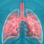 Lungs healthy: రాకెట్ టెక్నాలజీతో    ఊపిరితిత్తులకు ఆరోగ్యం..
