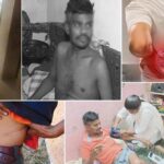 Visakhapatnam : కిడ్నీ రాకెట్ కలకలం ..డబ్బులు ఎర.. అమాయకులకు వల..