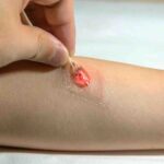 Graphene Tattoo:- గ్రాఫెన్ టాటూ.. గుండెకు మంచిది..