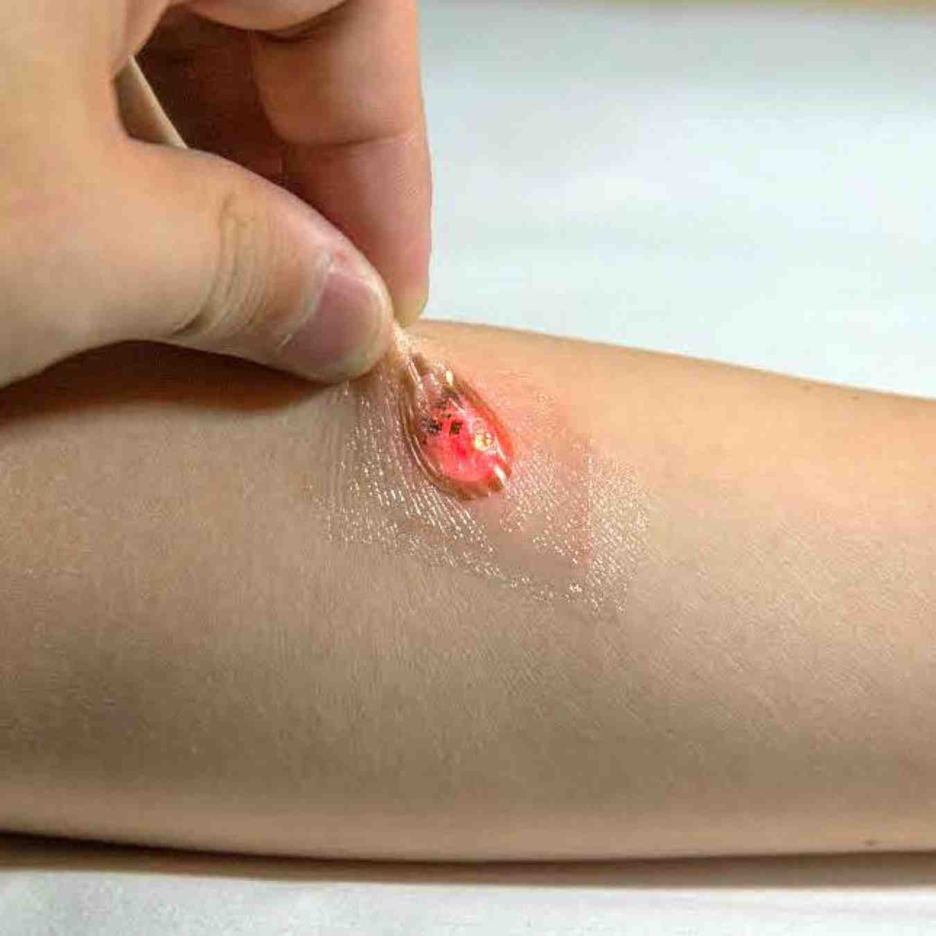 Graphene Tattoo:- గ్రాఫెన్ టాటూ.. గుండెకు మంచిది..