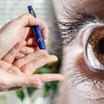 Diabetic Eye Disease:- మధుమేహం మీ కళ్లలోనే తెలిసిపోతుంది!