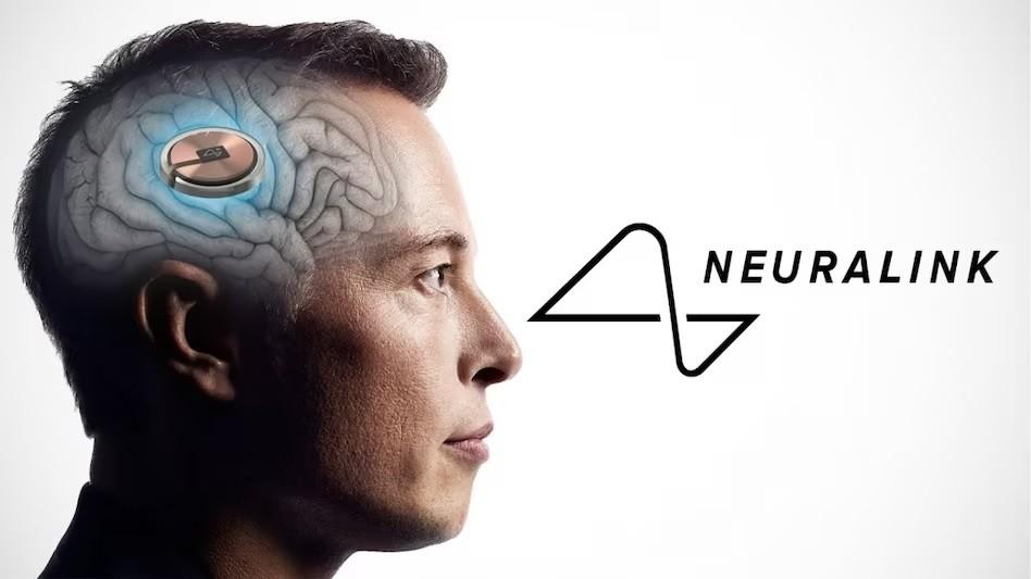 Neuralink: ఇస్మార్ట్ మస్క్.. మెదడులో న్యూరాలింక్ చిప్‌..