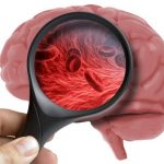 Brain diseases : రక్తనాళాలలోని మార్పులతో మెదడు వ్యాధులు గుర్తింపు..