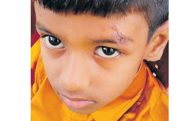 Hospital: దెబ్బ తగిలితే కుట్లు వేయకుండా ఫెవిక్విక్‌తో అతికించేశారు.. ప్రైవేట్ ఆసుపత్రి నిర్వాకం..