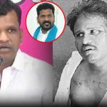 BRS MLA : లాయర్ పై ఎమ్మెల్యే గాదరి కిషోర్ అనుచరుల దాడి.. బాధితుడికి రేవంత్ పరామర్శ..