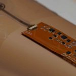 Smart Bandage : స్మార్ట్ టెక్నాలజీ సాయంతో గాయం నయం..