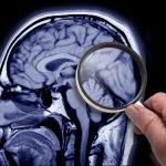 AI for Alzheimers Disease : ఏఐ సాయంతో అల్జీమర్స్ గుర్తింపుకు ప్రయత్నం..