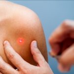 App That Recognize Skin Cancer  : చర్మ సమస్యల నుండి క్యాన్సర్ వరకు.. అన్నీ కనిపెట్టే యాప్..