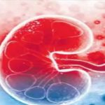 Kidney Racket : ఏపీలో మరో కిడ్నీ రాకెట్.. విజయవాడ కేంద్రంగా దందా..