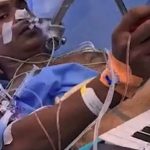 Craniotomy : ఆపరేషన్ చేస్తుండగా మెలోడీ సాంగ్స్.. ఆ పేషంట్ ఏం చేశాడంటే..