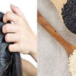 Hair Care : నల్ల నువ్వులు..చుండ్రుకు చెక్ ..