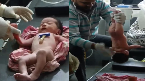 Chanchalguda Jail: కడుపు నొప్పితో ఖైదీ విలవిల.. లోపలున్నవి చూసి షాకైన వైద్యులు..