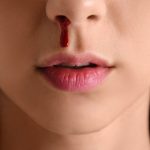 Nose Bleeding : ముక్కు నుంచి రక్తస్రావం జరిగితే ఏమోతుందో తెలుసా..?