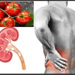 Tomato : టామాటాలు తింటే కిడ్నీలో రాళ్లు ఏర్పడుతాయా..?