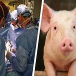 Pig Kidney to Human: మనిషికి పంది కిడ్నీ.. ఇదో మెడికల్ మైల్ స్టోన్ అన్న వైద్యులు!