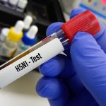 Bird Flu Infected to Humans: మనుషులకు వ్యాపిస్తున్న బర్డ్ ఫ్లూ.. రెండో కేసు నమోదు.. నివారణ ఎలా..?