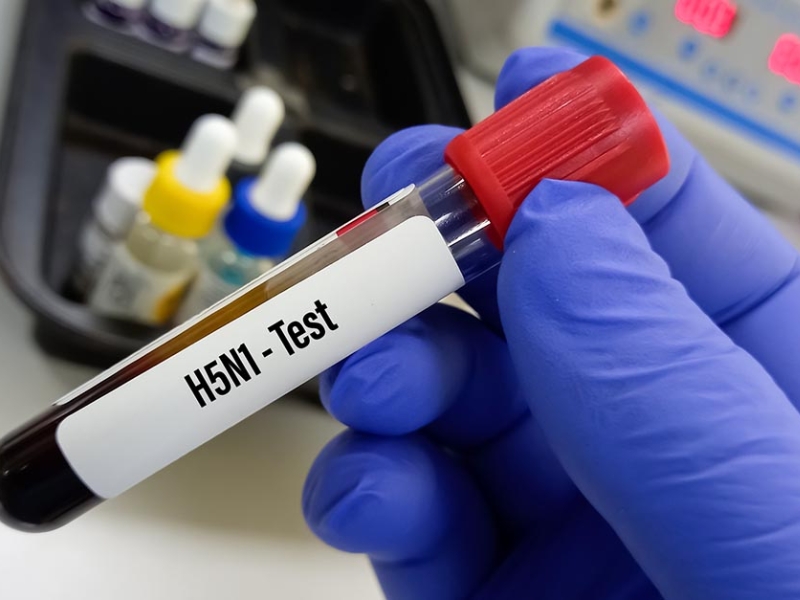 Bird Flu Infected to Humans: మనుషులకు వ్యాపిస్తున్న బర్డ్ ఫ్లూ.. రెండో కేసు నమోదు.. నివారణ ఎలా..?