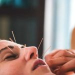 Acupuncture : ఆక్యుపంక్చర్‌ చికిత్స అంటే ఏమిటి? ఇది ఎలా పనిచేస్తుంది?