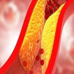 Cholesterol Diet: మందు, మాంసం.. శరీరంలో కొవ్వును చెంచేస్తాయి..!