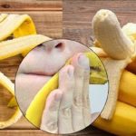 Banana Peel Benefits: అరటి తొక్కతో అందం మీ సొంతం!