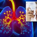 World Asthma Day 2024: ఆస్తమా గురించి ఈ విషయాలు మీకు తెలుసా?