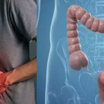 Colon Cancer in Youth: యువతకు పెద్దపేగు క్యాన్సర్ ముప్పు.. కారణమిదే..!