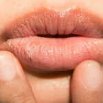 Chapped Lips in Summer: వేసవికాలంలో పెదవులు పొడిబారడానికి కారణం తెలుసా..? ఈ చిట్కాలు పాటిస్తే అంతా సెట్!