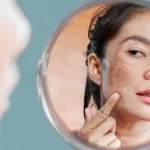 Hyper Pigmentation: పిగ్మెంటేషన్ తో ఇబ్బంది పడుతున్నారా?  ఈ చిట్కాలు మీ కోసమే..